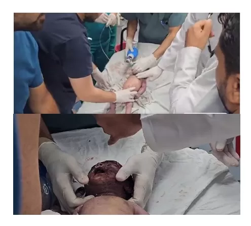 Heart-wrenching Video Captures the Moment a Palestinian Infant is Martyred Due to Israeli Bombing