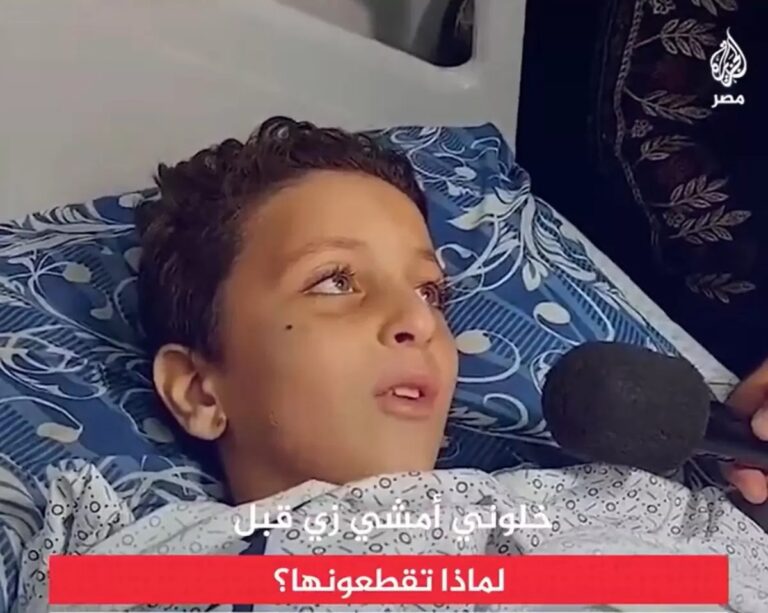 Desperate plea for help: Palestinian child faces leg amputation urges Egyptians for treatment (video)