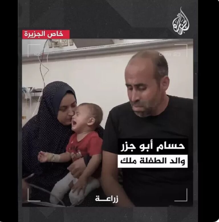 innocence shattered: Palestinian girl toddler’s limbs amputated in Israeli bombardment