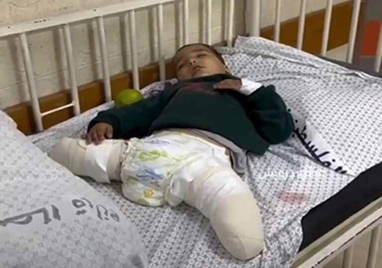 A heartbreaking video of a Palestinian child who lost his family and his legs in the Israeli occupation’s bombing