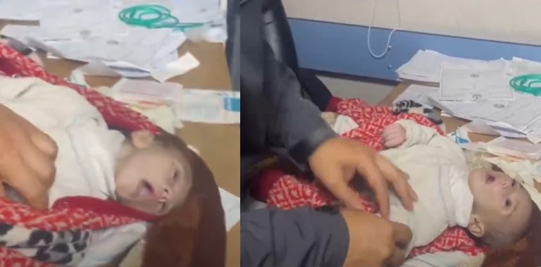 Tragic Reality: Palestinian Infant Starves, Mother’s Tears Speak of Helplessness