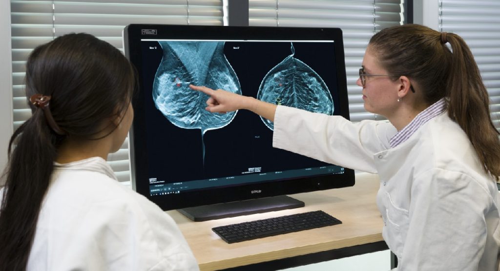 Breast cancer AI detection