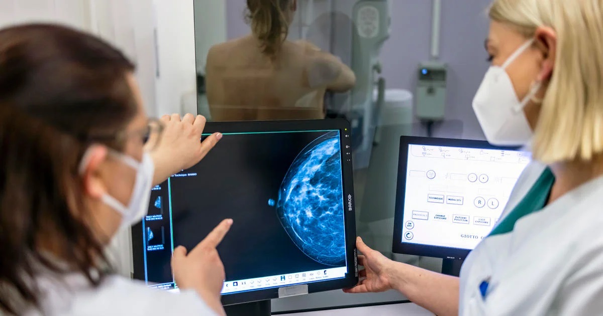 Breast cancer AI detection