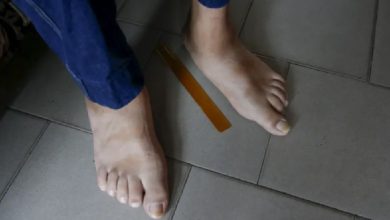 your feet can help detect serious medical conditions early.