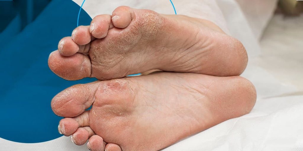  your feet could indicate issues like circulatory problems